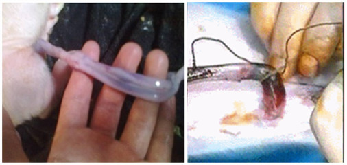 ������ʹ�ý���Ѫ��ĸ��Ч��ͼ